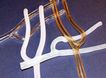 Arterial